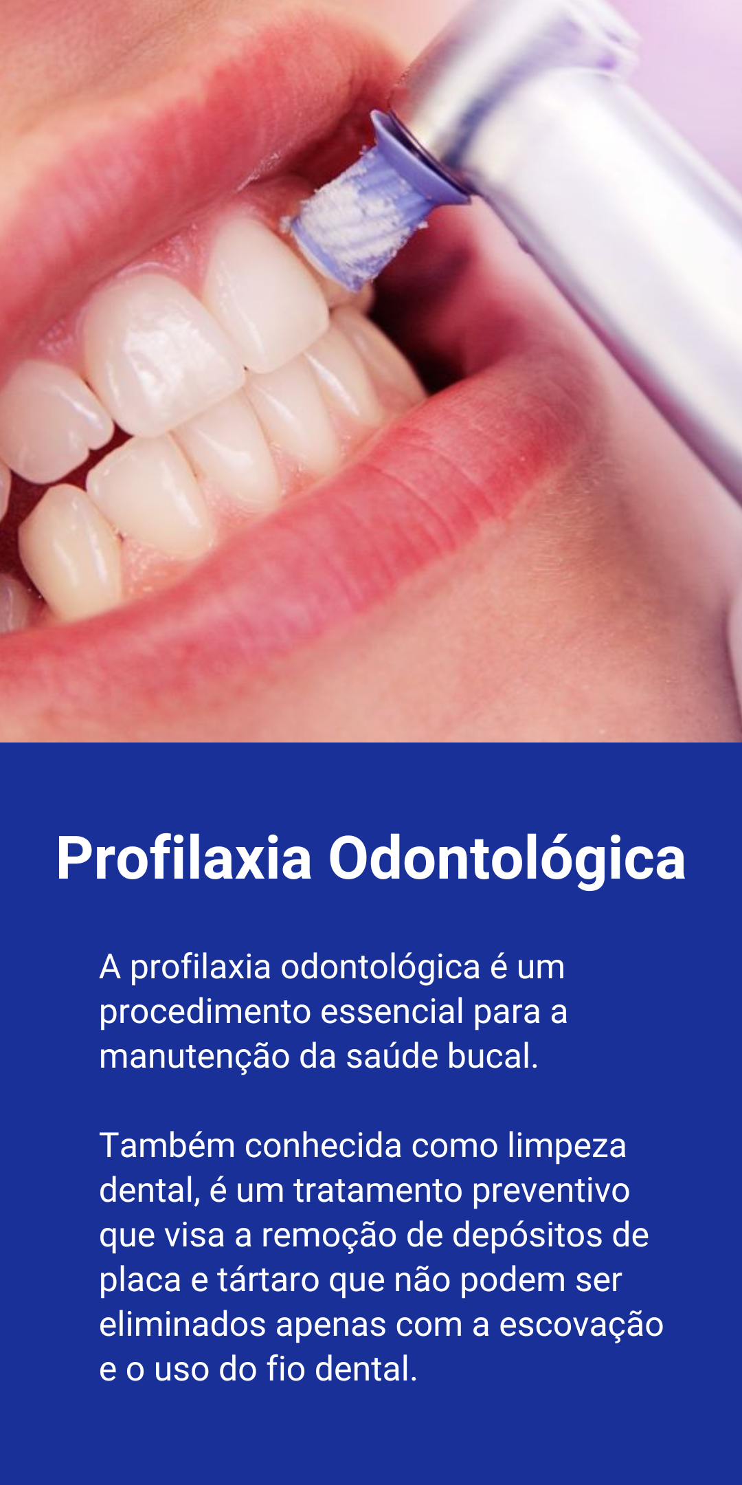 O clareamento dental a laser é uma das técnicas mais modernas e eficazes para quem deseja um sorriso mais branco e radiante. Este procedimento utiliza um laser para ativar o gel clareador aplicado (1)